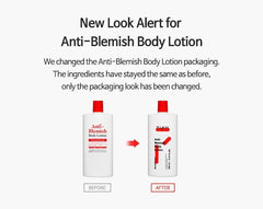 Anti Blemish Body Lotion Back & Chest 2pcs Bundle Set