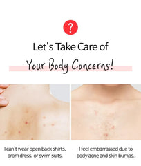 Anti Blemish Body Lotion Back & Chest 2pcs Bundle Set