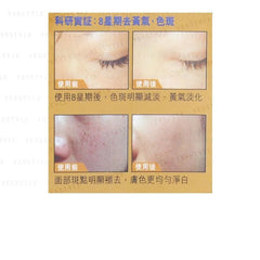 Anti-Yellowish Serum