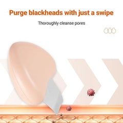 Blackhead Scraper Remover