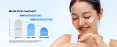 YesStyle Exclusive Relief Sun Aqua-fresh Bundle Set