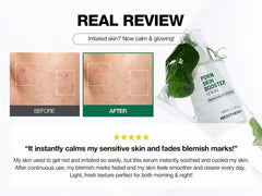 PDRN Skin Booster Set