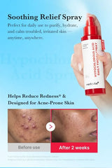 Hypochlorous Acid Daily Facial Spray