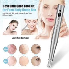 Microneedling Stamp Pen USB Rechargeable