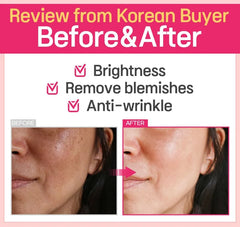 Small Molecular Collagen C 5pcs Bundle Set
