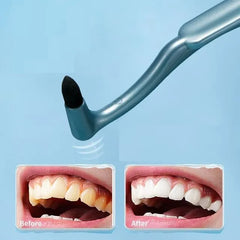 Teeth Stain Cleaning Brush