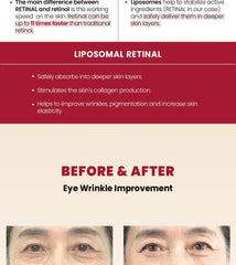 SEOUL 1988 Eye Cream : Retinal Liposome 4% + Fermented Bean