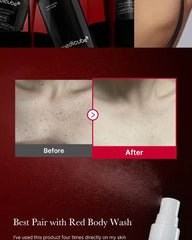 Red Acne Body Peeling Shot  2pcs Bundle Set