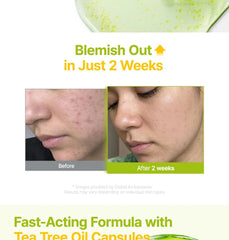 Azelaic Acid 10 Kojic Tea Tree Serum