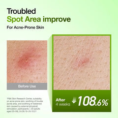 Kpop Demon Hunters Azelaic Acid 10 Hyaluron Redness Soothing Serum Set